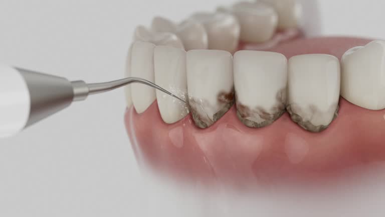 Reliable Emergency Dentist contractor in Dunkirk, MD by Smile Center Dentistry